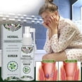 thumbnail image 5 of Spray herbal natural para hemorroides. Tratamiento indoloro para las hemorroides. 30 ml., 5 of 5