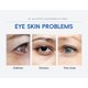 thumbnail image 5 of Xihbxyly Crema Intensiva para Ojos, Fórmula Reafirmante y Reparadora, Reduce Bolsas y Líneas de Expresión, Tratamiento Hidratante E Iluminador, Rutina Antiedad Diaria, Apta para Todo Tipo de Piel, 5 of 7