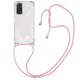 thumbnail image 1 of Funda FOXDOCK para Xiaomi Redmi Note 11/11s 4G con Cuerda Ajustable, Brillo Líquido, Protección Antigolpes y Lente – Ideal para Regalo, 1 of 6