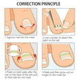 thumbnail image 6 of Ingrown Toenail Corrector Strips Brace - 10pcs/Set, Curved BS Brace for Thick Toenails, Straightener Clip for Toenail Recovery, Safe & Easy to Use Foot Correction Tool Makeup Organizers, 6 of 9