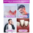 thumbnail image 4 of Pasta de dientes CAREDO Healing Temprano-Media Periodontitis 100ml, 4 of 6