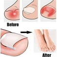 thumbnail image 7 of 100 Pcs Ingrown Toenail Corrector Strips with Toenail Lifter,Ingrown Toenail Correction Brace Toenail Correction Clip Toenail Straightening Recover Curved Toenail Corrector for Women Men Foot Care, 7 of 7