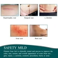 3 Meters Silicone Scar Stickers to Reduce Itching and Redness Scar