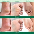 thumbnail image 3 of Mascarilla exfoliante de pies PLANTIFIQUE, paquete de 2 para hombres y mujeres, 3 of 7