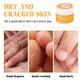 thumbnail image 4 of 10g Anti-Secado Crack Pie Crema Reparación Hidratante Eliminación de la piel muerta Cuidado Tmvgtek cuidado belleza, 4 of 8
