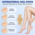 thumbnail image 3 of 1-5x Oenail Fungus Patch Waterproof Nail Repair Patches Nail Ingrown Correction Stickers, 3 of 5