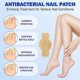 thumbnail image 3 of 1-5x Oenail Fungus Patch Waterproof Nail Repair Patches Nail Ingrown Correction Stickers, 3 of 5