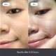 thumbnail image 2 of 360 Pcs Acne Pimple Patch For Covering Zits And Blemishes, Spot Stickers For Face And Skin, Vegan-friendly And Not Tested On Animals, For Men And Women Daily Skin Care, 2 of 4