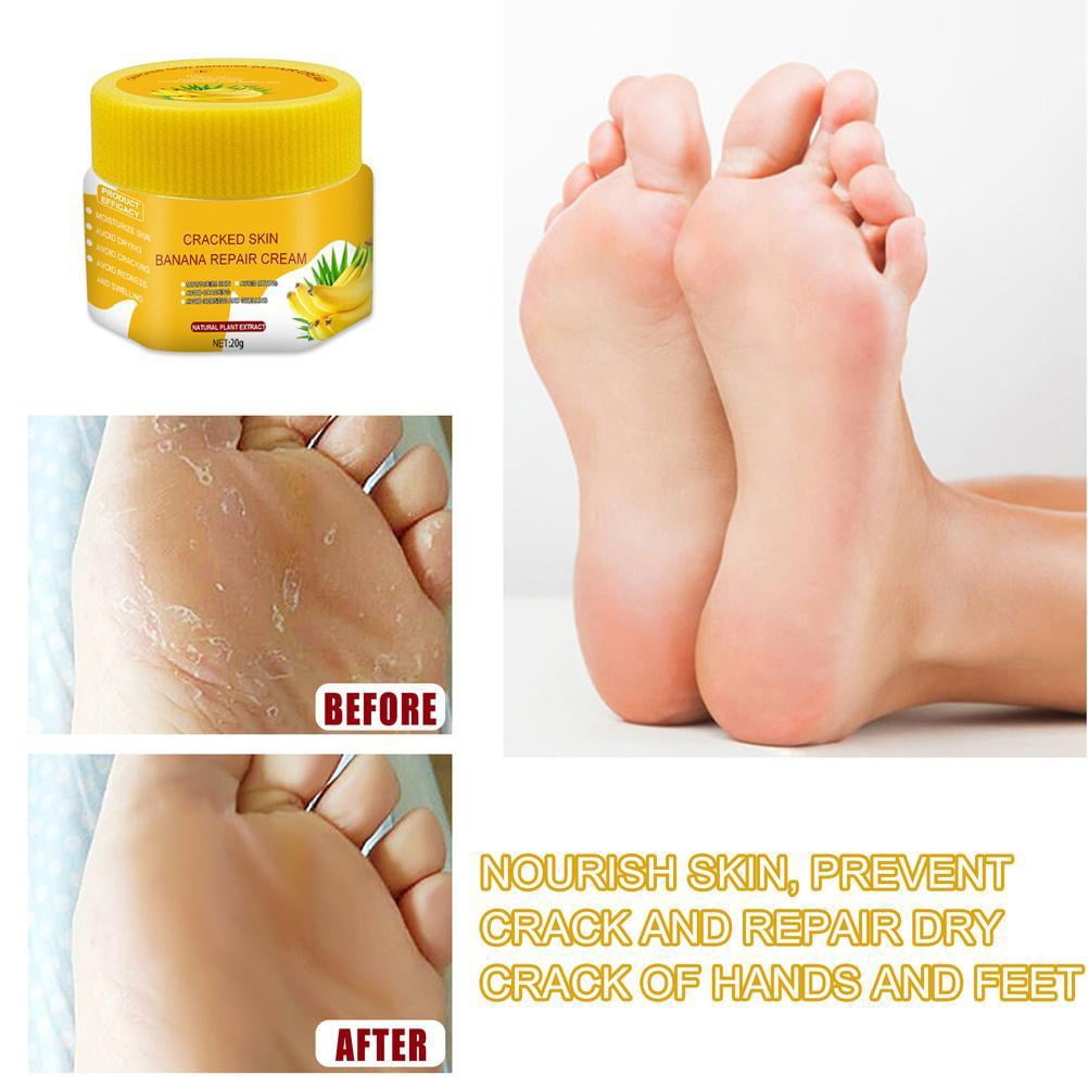 Dry feet care best sale