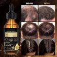 thumbnail image 4 of ONLYEOR Hair Essence Oil, Organic Hair Oil, Natural Hair Oils for Women and Men, for Men & Women, All Hair types 60ML, 4 of 7