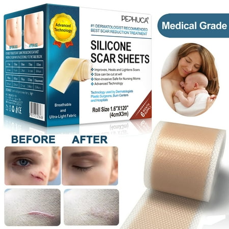 Pephuca Medical Grade Silicone Scar Sheets,120inch x 1.6inch,Reusable and Breathable Silicone Gel Tape for Scar Removal,Reusable 6 Months Supply