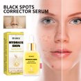 thumbnail image 2 of Xihbxyly Spray para Piel Limpia, Tratamiento para Atenuar Manchas En Codos, Corrección Iluminadora de Rodillas, Solución para Aclarar La Melanina En Tobillos, Cuidado de Las Articulaciones, Mejora Di, 2 of 7