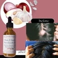 thumbnail image 3 of All Natural Red Onion & Garlic Ayurvedic Hair Growth Oil For Natural Hair, Safe For Womens, Mens and Childrens Hair, 3 of 10
