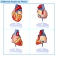 thumbnail image 2 of Modelo anatómico de corazón humano a escala 1:2 con 49 estructuras, 2 of 6