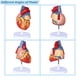thumbnail image 2 of Modelo anatómico de corazón humano a escala 1:2 con 49 estructuras, 2 of 6