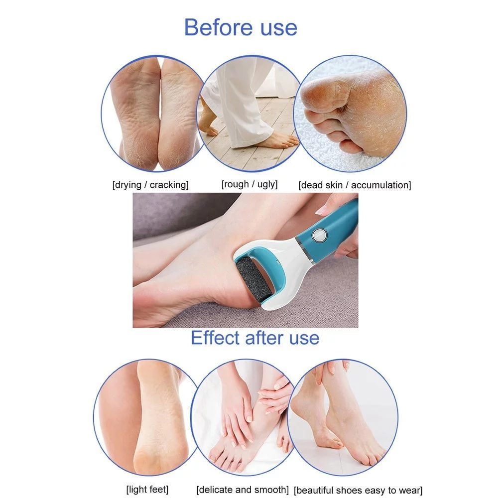 P2P Nails Foot File and Callus Remover - Metal Tool to Remove Dry Skin -  Salon Style Dead Skin Remover for Wet and Dry Feet - Professional Foot File