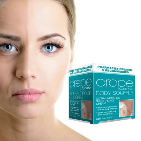 Crepe Gone Body Souffle Helps Smooth, Plump, And Firm Dry, Aging Skin (Set of (Best Cream For Crepey Skin)