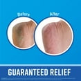 O'Keeffe's for Healthy Feet Foot Cream, Guaranteed Relief for Extremely