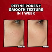 Thayers 2% AHA Exfoliating Toner, Smoothing and Pore Refining Skin Care for All Skin Types, 12 fl oz