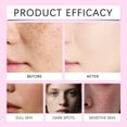 thumbnail image 3 of Dr.pedi Beauty Arbutin 7% + Tranexamic Acid 4% Cream, Niacinamide & Glutathione for Dark Spots, Freckles, Blemishes, Hyperpigmentation, 50ml/1.69 fl.oz, 3 of 8