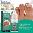 thumbnail image 3 of Fungal Nail Treatment For Toenails Extra Strong-nail Fungus Treatment For Anti, 3 of 5
