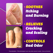 Silka Athletes Foot, Prescription Strength, Antifungal Cream, 1 oz