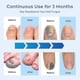 thumbnail image 3 of 2024 Nail Fungus Laser Treatment Device for Multiple Toenail, Home Use 905nm Infrared Light + 470nm Blue Light Toe Nail, 3 of 5