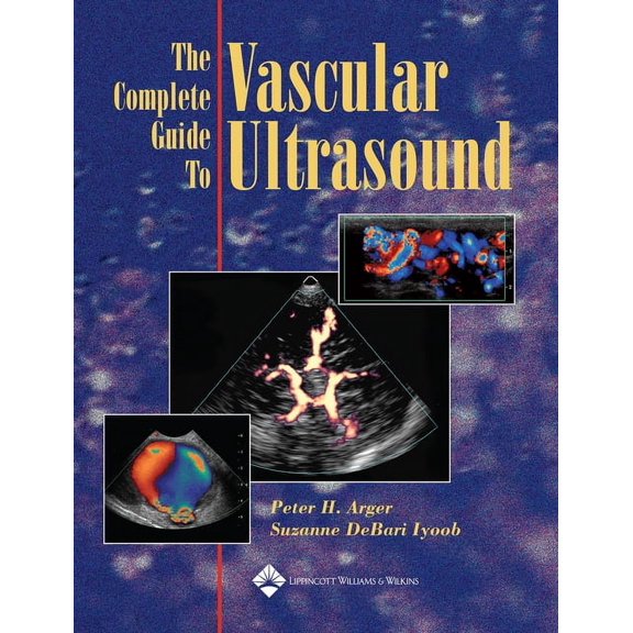 The Complete Guide to Vascular Ultrasound, (Paperback)
