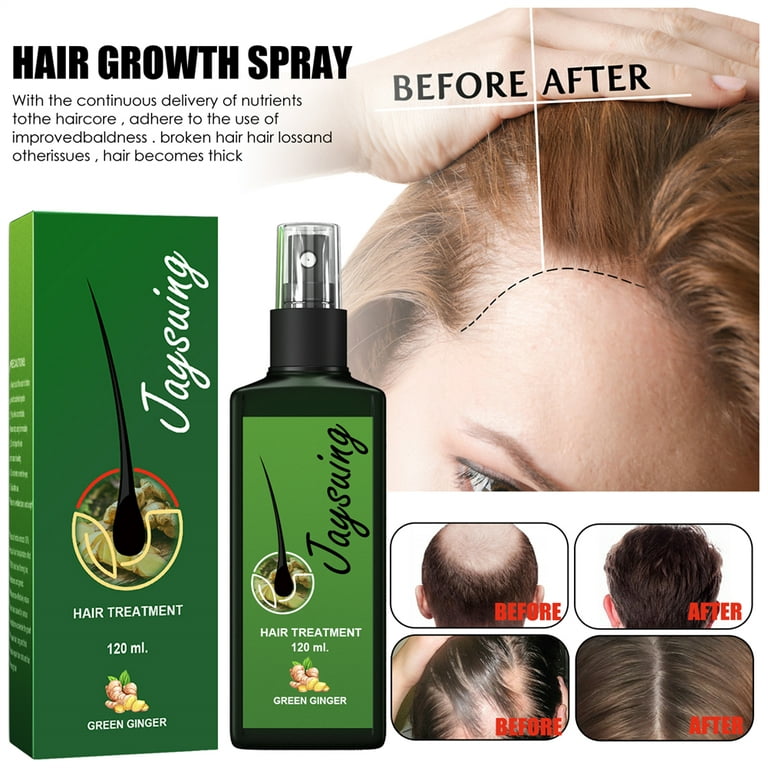 Jaysuing Hair Growth Spray Men's Hair Beard Dense Growth Care Solution –  jaynehoe