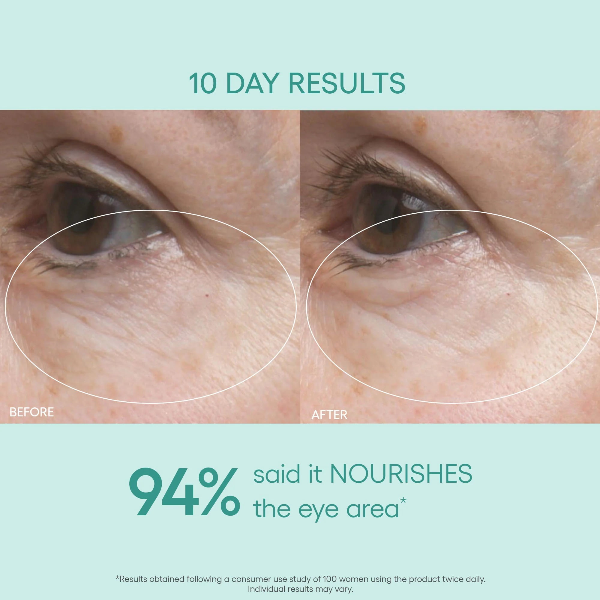 Algenist GENIUS Ultimate Anti-Aging Eye Cream – Firming Under Eye Cream with Collagen + Microalgae Oil – Helps to Visibly Plump, Smooth, and Restore Radiance to the Delicate Eye Area (0.5 oz)