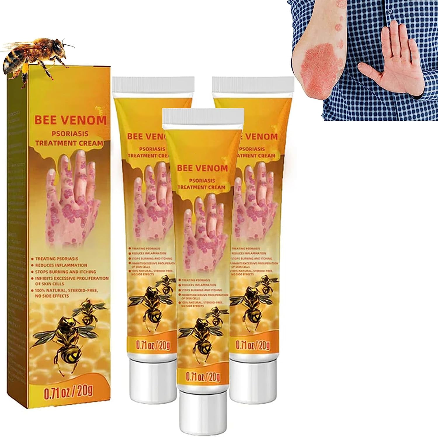 Banghong Youth Bee Venom Psoriasis Treatment Cream, New Zealand Bee ...