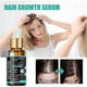 thumbnail image 2 of Jaysuing Dense Hair Essence Repair And Moisturize Dry Hair To Prevent Dense Hair, 2 of 5