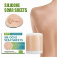 thumbnail image 2 of Self-Adhesive Silicone Scar Sheets - Medical Grade Scar Removal Patches for C-Section, Acne Scars, Keloid Surgery & Burn Scars, 2 of 5
