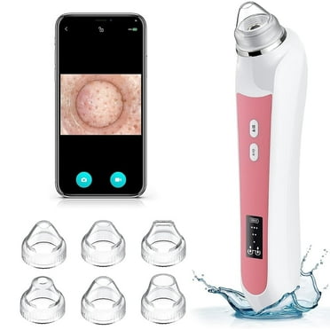 Ouwald Blackhead Remover, Pimple & Blackhead Extractor With 6 Suction Heads, Electric Black Head Remover Tools for Face, Facial Pore Cleaner Kit