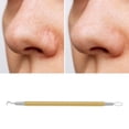 thumbnail image 5 of Unique Bargains 1 Pc Durable Double Headed Pimple Extractor Gold Tone, 5 of 7