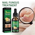 thumbnail image 2 of 30ml Nails Care Repair Nail Fungal Anti-Fungus Onychomycosis-Removal Liquid Ginger Foot Antifungal Nail Treatment Ginger Cuticle Care Oil, 2 of 5