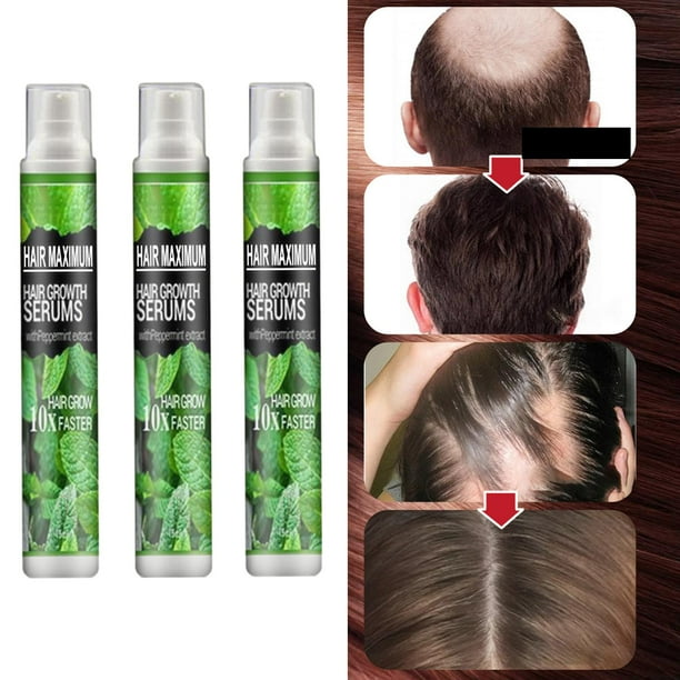 Hair-Growth Spray/ Anti / 10ml /Crecer m&aacute;s grueso/ r&aacute;pido/ M&aacute;s largo 3  piezas Zulema Aerosol de hierbas | Bodega Aurrera en l&iacute;nea