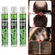 thumbnail image 3 of Spray de esencia para el crecimiento del cabello, anticaída, acelera el crecimiento del cabello. 3 piezas, 3 of 6