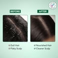 thumbnail image 5 of Botanic Hearth Tea Tree Shampoo and Conditioner Set - with 100% Pure Tea Tree Oil, for Itchy and Dry Scalp, Sulfate Free, Paraben Free - for Men and Women - 2 bottles 16 fl oz each, 5 of 10