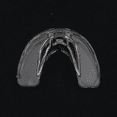 thumbnail image 3 of Brackets profesionales bordados ENTASSER funda para labios protector bucal flotante de silicona, 3 of 3