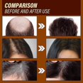 thumbnail image 4 of Ginger Hair Growth Essence Moisturizing And urishing Strength Repair Hair Follicle Damage Dry And, 4 of 5