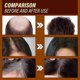 thumbnail image 4 of Ginger Hair Growth Essence Moisturizing And urishing Strength Repair Hair Follicle Damage Dry And, 4 of 5