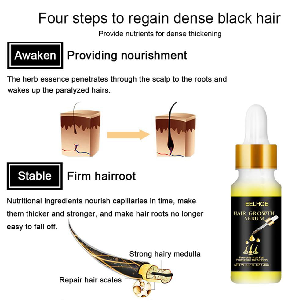 Hair Growth Serum Anti Hair Loss Hair Serum Balance Loss Hair Serum Hair  Grease for Men And Women Ginger Hair Growth Liquid | Walmart Canada