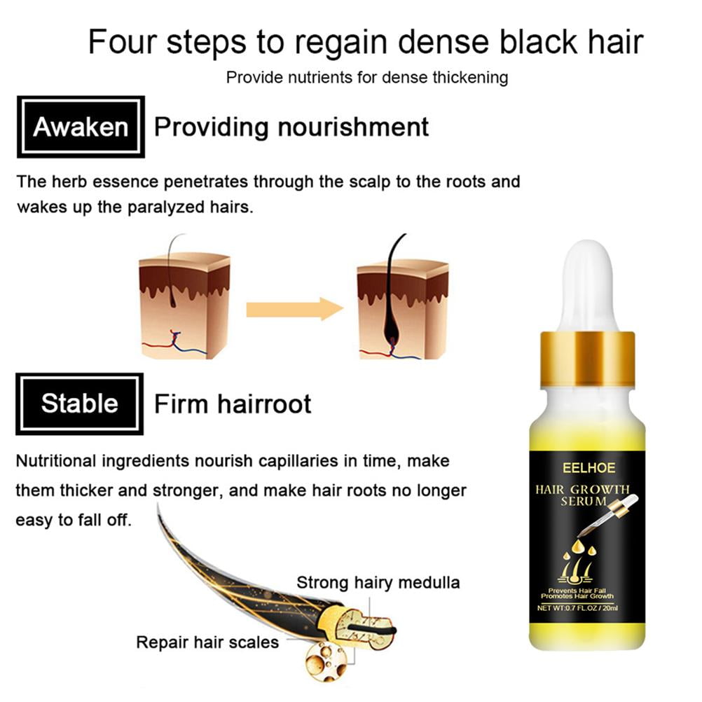 Hair Growth Serum Anti Hair Loss Hair Serum Balance Loss Hair Serum Hair Grease for Men And Women Ginger Hair Growth Liquid | Walmart Canada Hair Growth Serum Anti Hair Loss Hair Serum Balance Loss Hair Serum Hair Grease for Men And Women Ginger Hair Growth Liquid | Walmart Canada