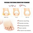 thumbnail image 4 of Juego De Herramientas De Pedicura Profesional De Corrección, Recortador De Uñas De Los Pies, Fijador De Corrección De Uñas Encarnadas, Cuidado De Los Pies, 4 of 7