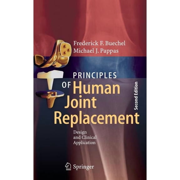 Principles of Human Joint Replacement: Design and Clinical Application, (Hardcover)