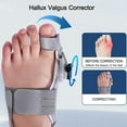 thumbnail image 2 of Treatmedy Bunion Fix-SinKeeU, 2 of 4
