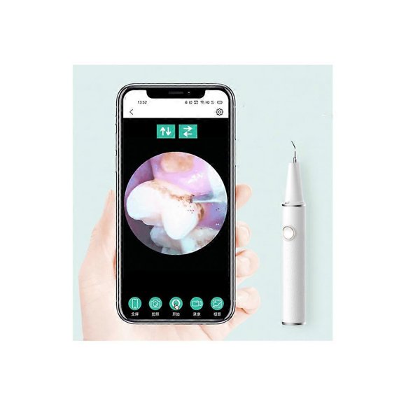 WiFi Visual Scaler for Home Scaling to Remove Tartar and Brighten Real Ultrasonic Teeth Cleaners White