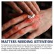 thumbnail image 3 of 1/2/3Pcs 30g Chilblain Cream Anti-cracking Frostbite Moisturiser Deep Nourishing, 3 of 5