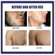 thumbnail image 4 of Men'S Hair Removal Cream Men'S Facial Beard Removal Cream Beard Hair Removal Cream Hair Removal Instrument Hair Rem, 4 of 5